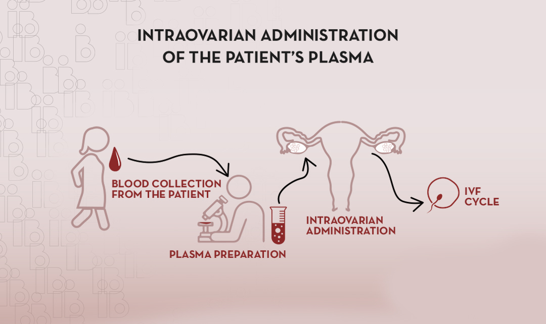 Intrauterine PRP (Platelet Rich Plasma)