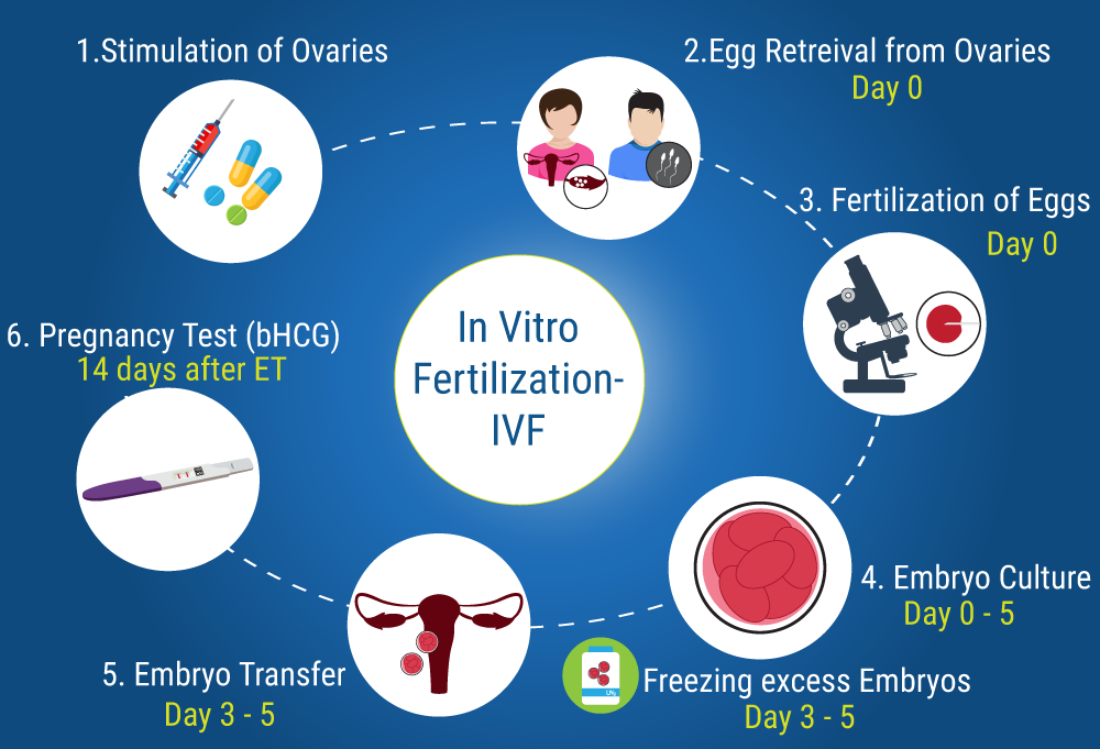 Step of  In Vitro Fertilization (IVF)